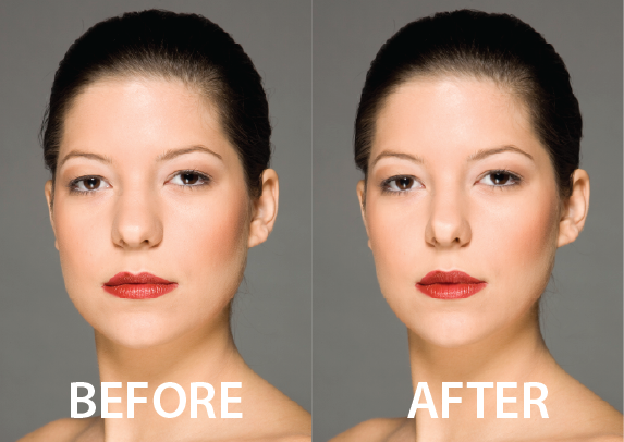Cosmetic Retouch
